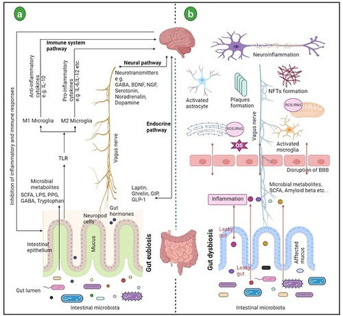 Diagramma delle connessioni tra microbiota intestinale e il morbo di Alzheimer